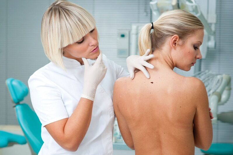 por que aparecen papilomas no corpo humano