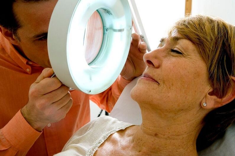 procedemento de exame do papiloma facial
